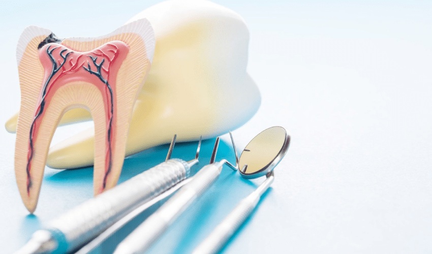 Endodontics Dentistry